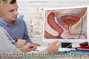 Best Treatment For Prostate Cancer In Early Stages